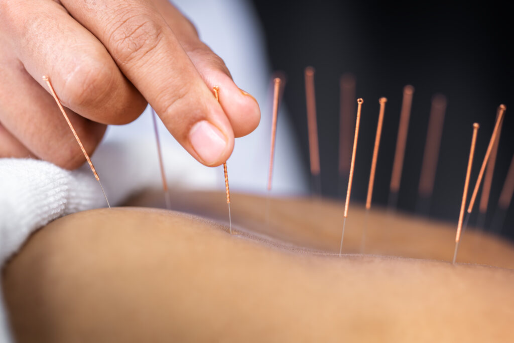 Leading Holistic Therapy in Atlanta, GA