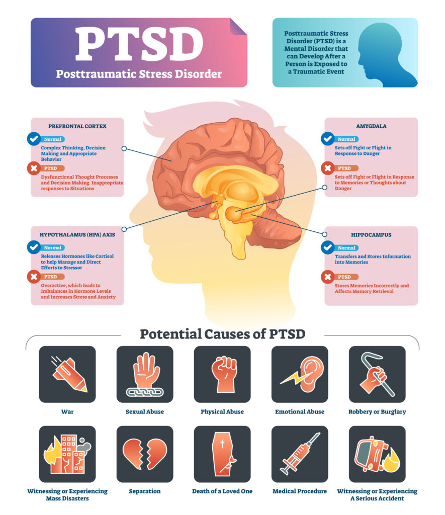 Leading PTSD Treatment Center in Atlanta, GA